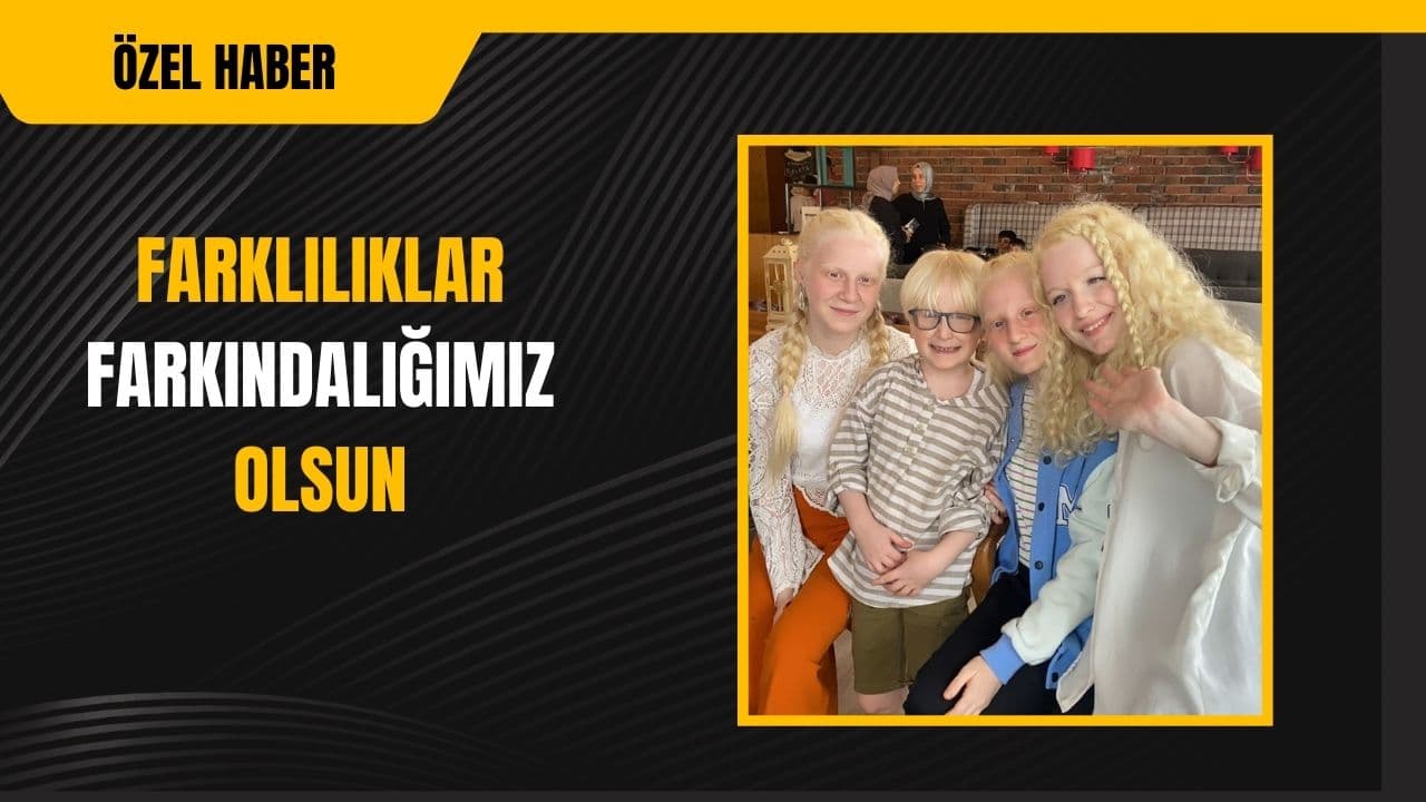 Albinizmli bireyler dernekleriyle farkındalık yaratıyor