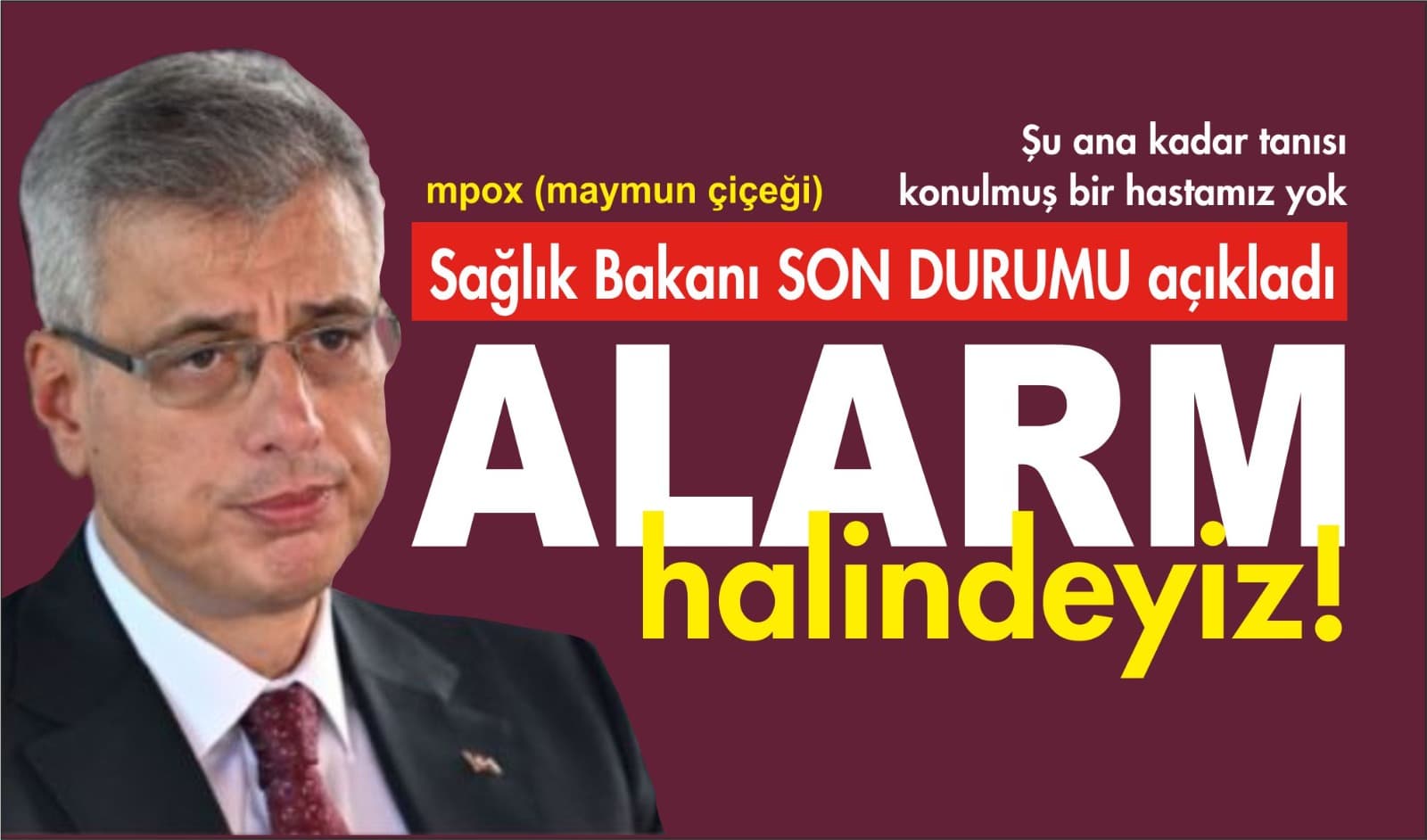 Sağlık Bakanı mpox için konuştu: Alarm halindeyiz!