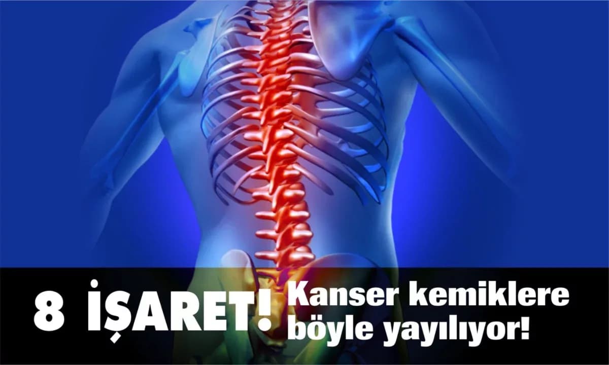 Kanserin Kemiklere Yayıldığının 8 İşareti