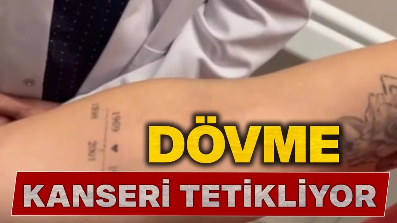 Dövme yaptırayım derken kansere yakalanmayın