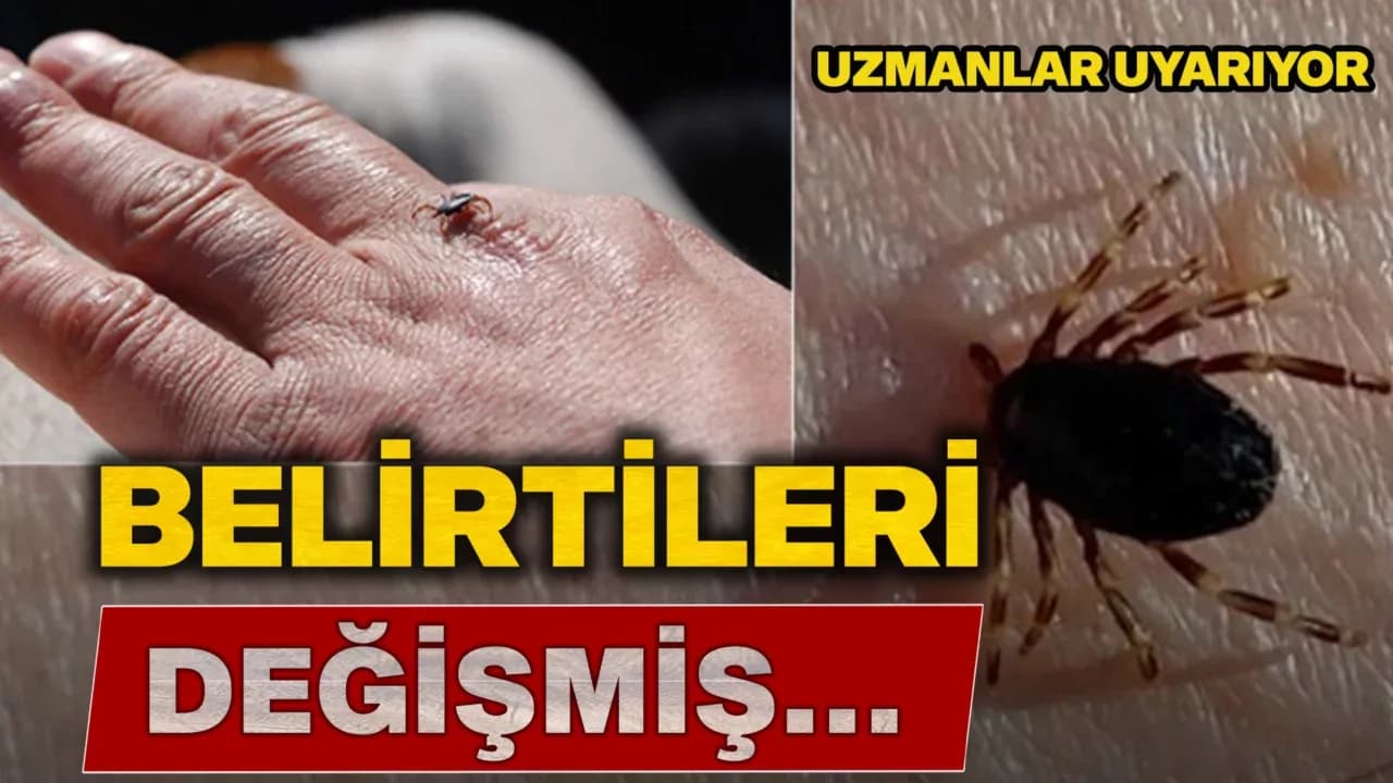 Uzmanlardan ’kene’ uyarısı: "Belirtiler keneye has değil, hemen ortaya çıkmayabiliyor"