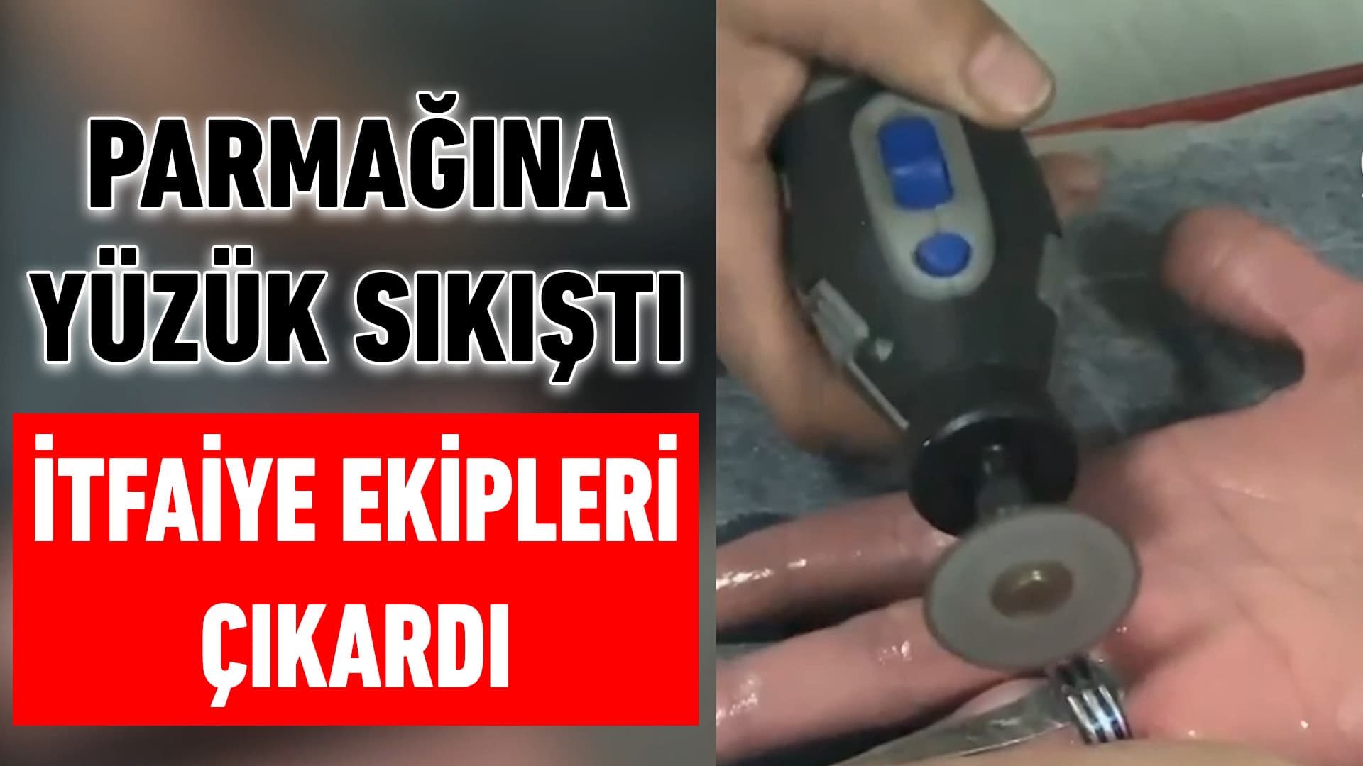 Bir kişinin parmağına sıkışan yüzük itfaiye ekiplerince çıkarıldı